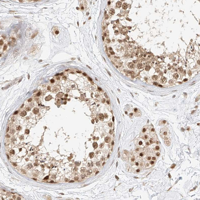 CXorf58 Antibody in Immunohistochemistry (Paraffin) (IHC (P))