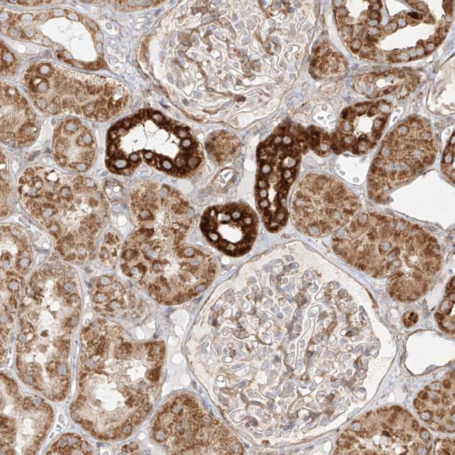 MTX2 Antibody in Immunohistochemistry (Paraffin) (IHC (P))