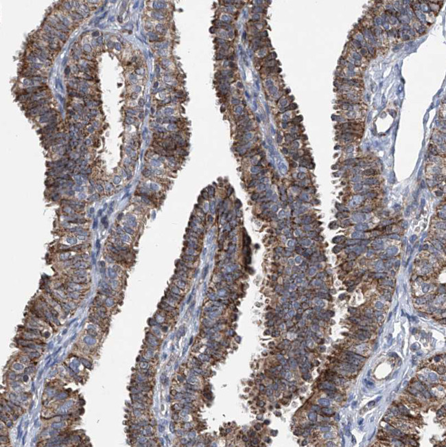 BCKDHB Antibody in Immunohistochemistry (Paraffin) (IHC (P))