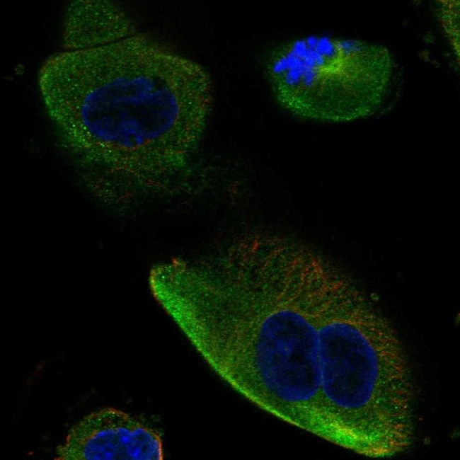 DCDC2 Antibody in Immunocytochemistry (ICC/IF)