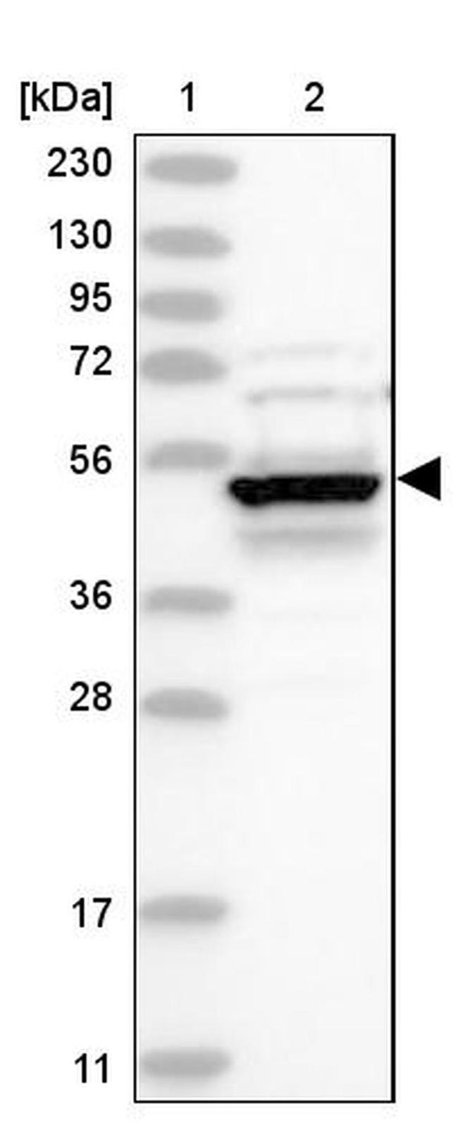 DCDC2 Antibody in Western Blot (WB)