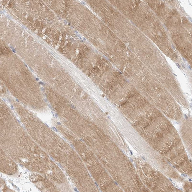 SLC2A12 Antibody in Immunohistochemistry (Paraffin) (IHC (P))