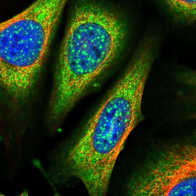 ARHGAP18 Antibody in Immunocytochemistry (ICC/IF)