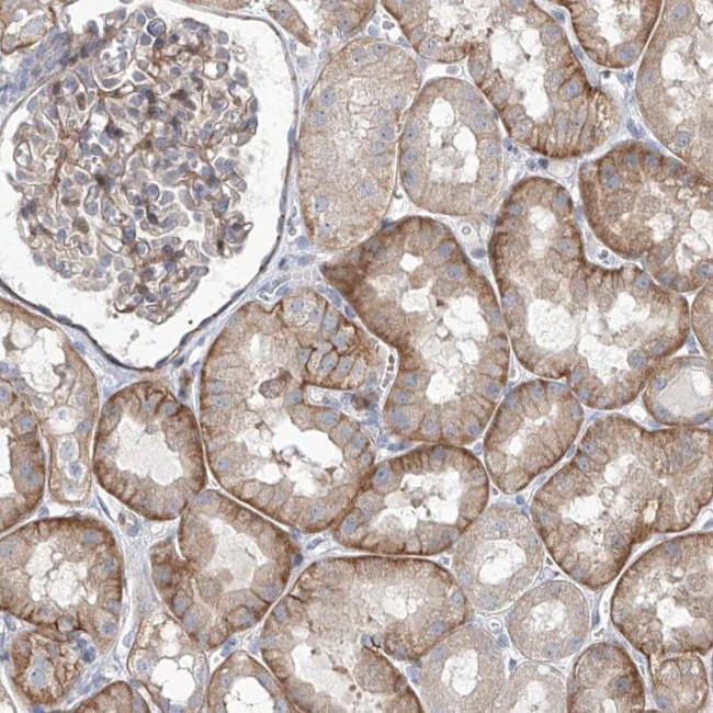 Lano Antibody in Immunohistochemistry (IHC)