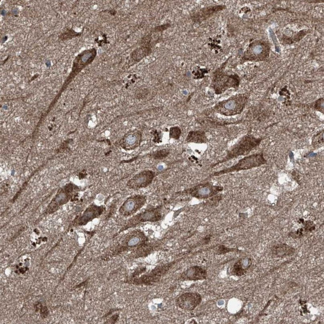 FOXRED2 Antibody in Immunohistochemistry (IHC)
