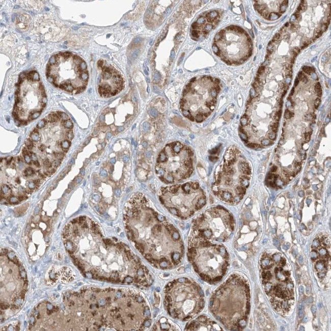 FOXRED2 Antibody in Immunohistochemistry (Paraffin) (IHC (P))