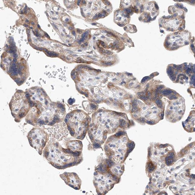 FASTK Antibody in Immunohistochemistry (Paraffin) (IHC (P))