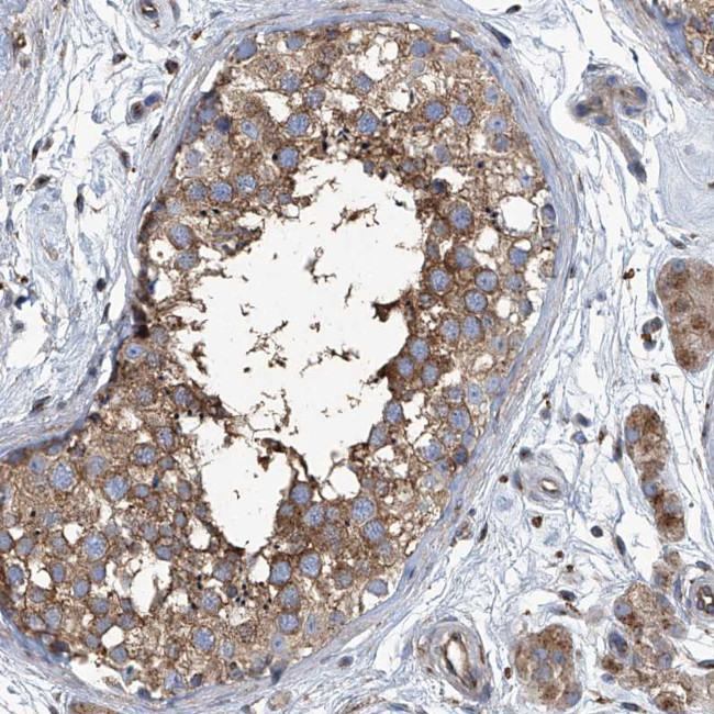 PIGH Antibody in Immunohistochemistry (Paraffin) (IHC (P))