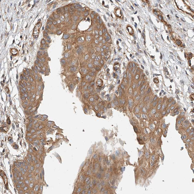 GHDC Antibody in Immunohistochemistry (Paraffin) (IHC (P))