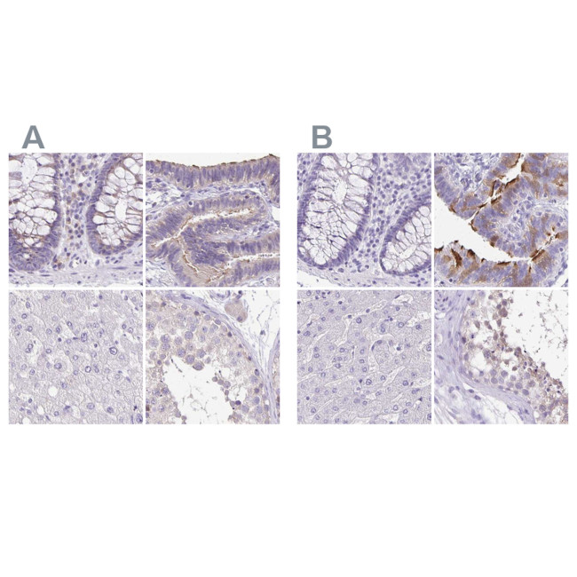 ANKRD45 Antibody in Immunohistochemistry (IHC)