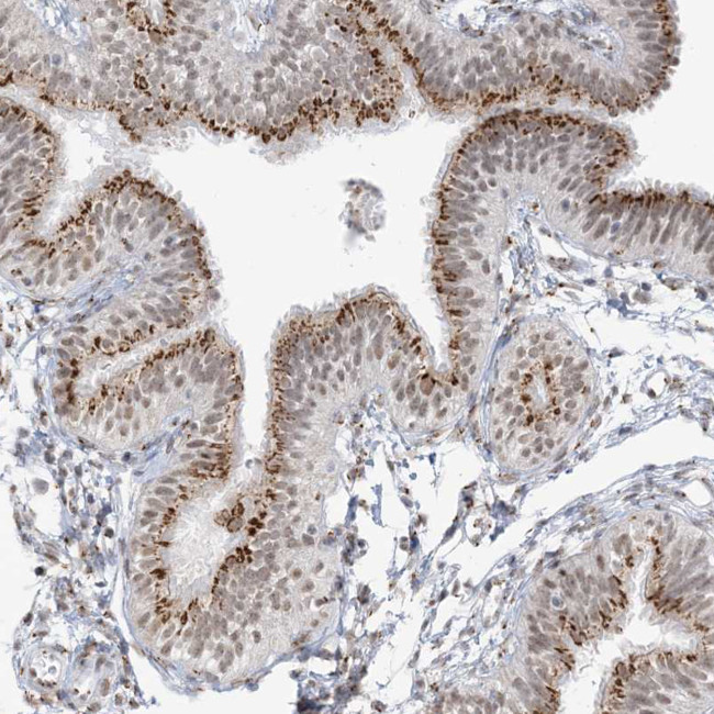 GPR107 Antibody in Immunohistochemistry (Paraffin) (IHC (P))