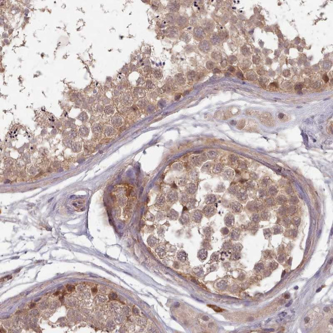 CLNS1A Antibody in Immunohistochemistry (Paraffin) (IHC (P))