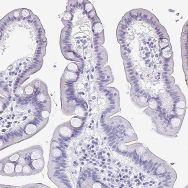 PERM1 Antibody in Immunohistochemistry (Paraffin) (IHC (P))