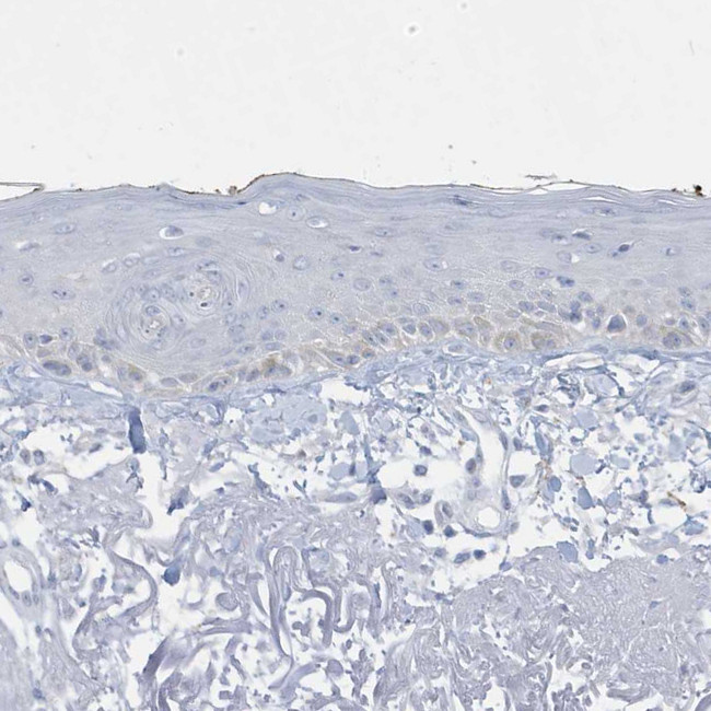 PERM1 Antibody in Immunohistochemistry (Paraffin) (IHC (P))