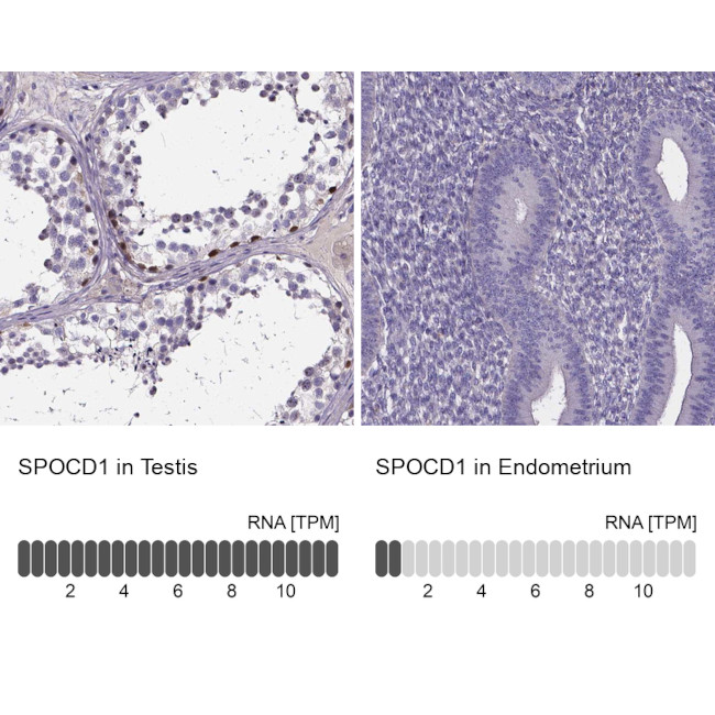 SPOCD1 Antibody in Immunohistochemistry (IHC)