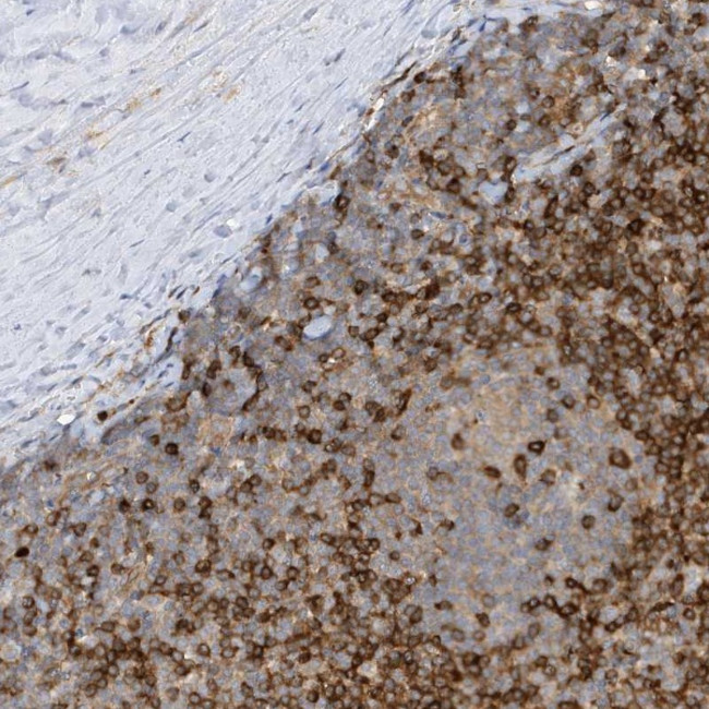 PHACTR2 Antibody in Immunohistochemistry (Paraffin) (IHC (P))