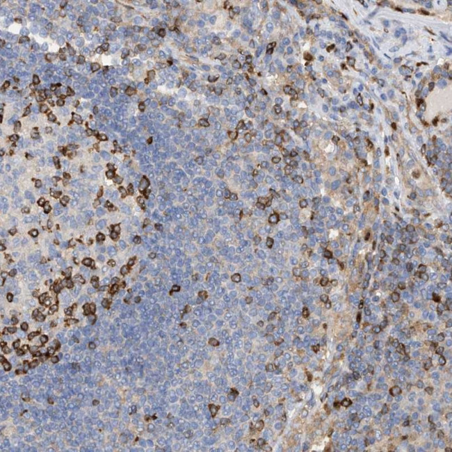 PHACTR2 Antibody in Immunohistochemistry (Paraffin) (IHC (P))
