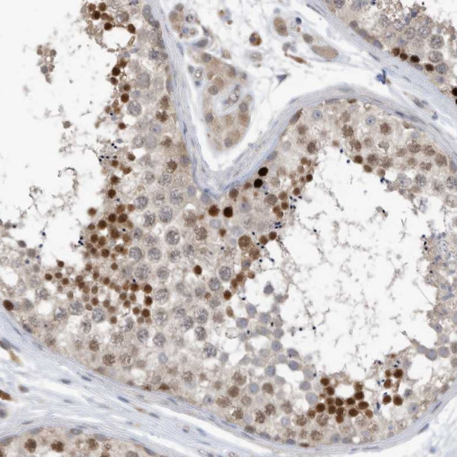 REC8 Antibody in Immunohistochemistry (Paraffin) (IHC (P))