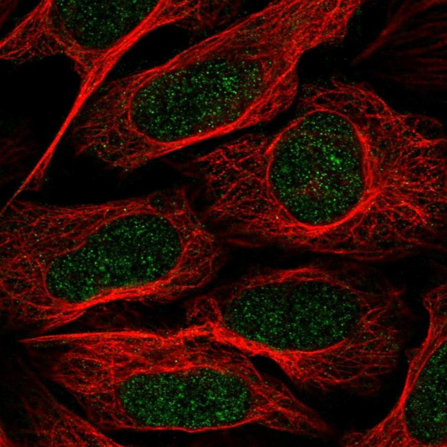 TAF8 Antibody in Immunocytochemistry (ICC/IF)