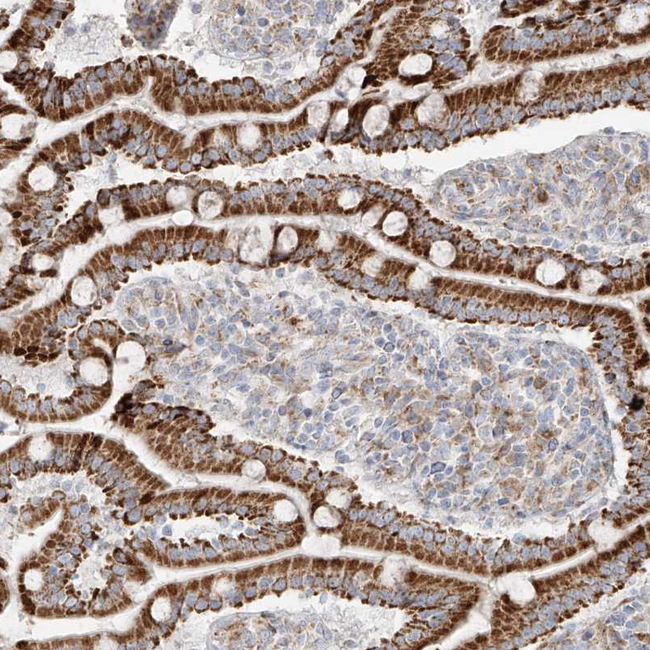 COLGALT2 Antibody in Immunohistochemistry (Paraffin) (IHC (P))