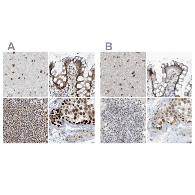 WHIP Antibody in Immunohistochemistry (IHC)