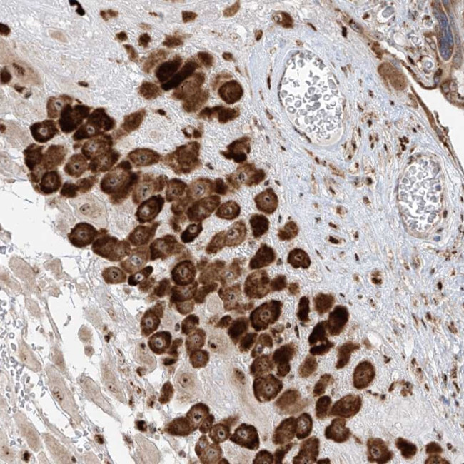 ZBTB8A Antibody in Immunohistochemistry (Paraffin) (IHC (P))
