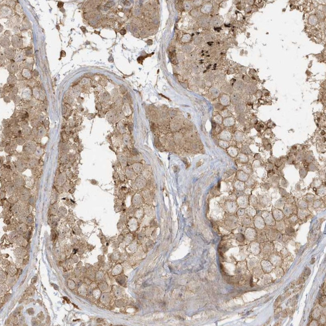 ZBTB8A Antibody in Immunohistochemistry (Paraffin) (IHC (P))