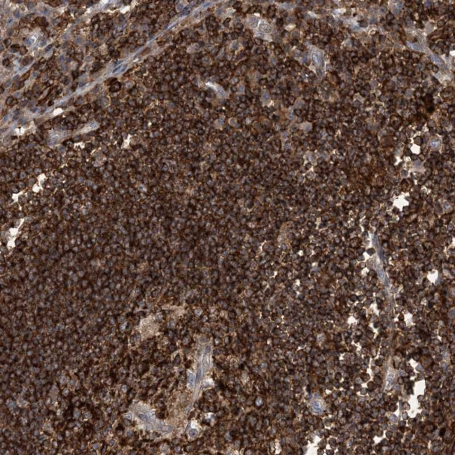 Adenylate Kinase 9 Antibody in Immunohistochemistry (Paraffin) (IHC (P))
