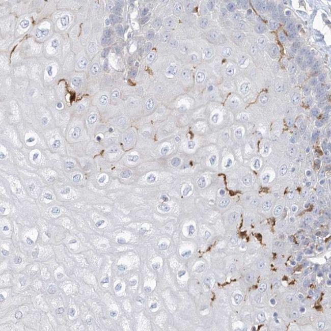 ATP13A1 Antibody in Immunohistochemistry (Paraffin) (IHC (P))
