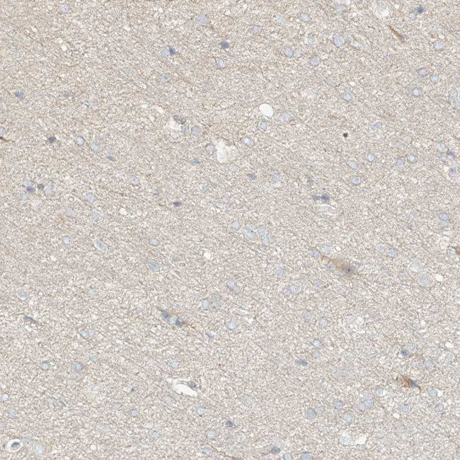 UPK1B Antibody in Immunohistochemistry (Paraffin) (IHC (P))