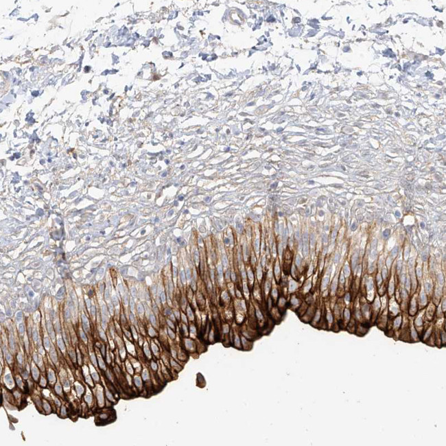UPK1B Antibody in Immunohistochemistry (Paraffin) (IHC (P))