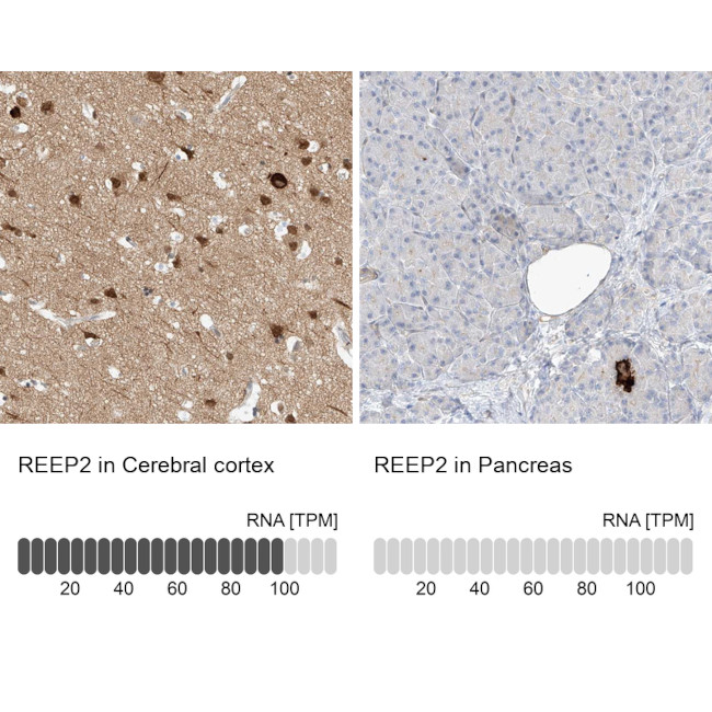REEP2 Antibody in Immunohistochemistry (IHC)