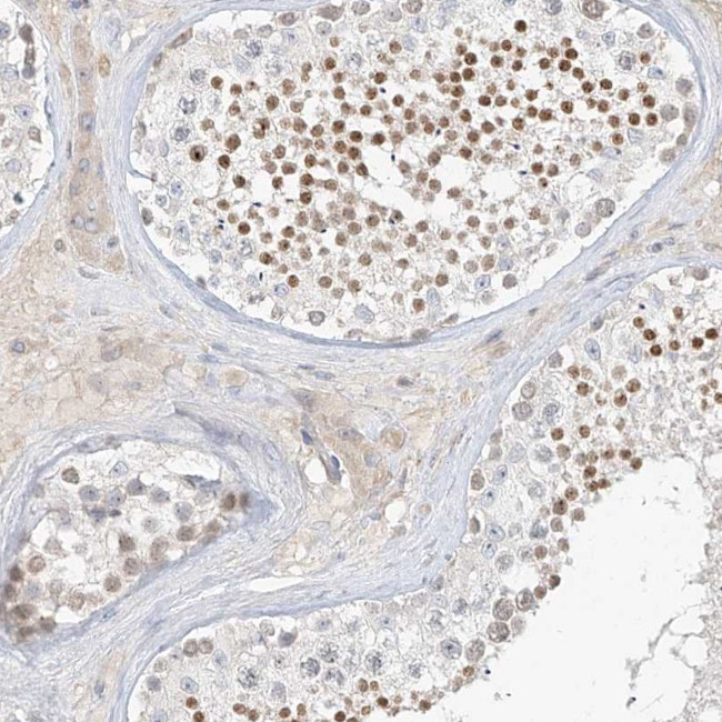 C2orf42 Antibody in Immunohistochemistry (Paraffin) (IHC (P))