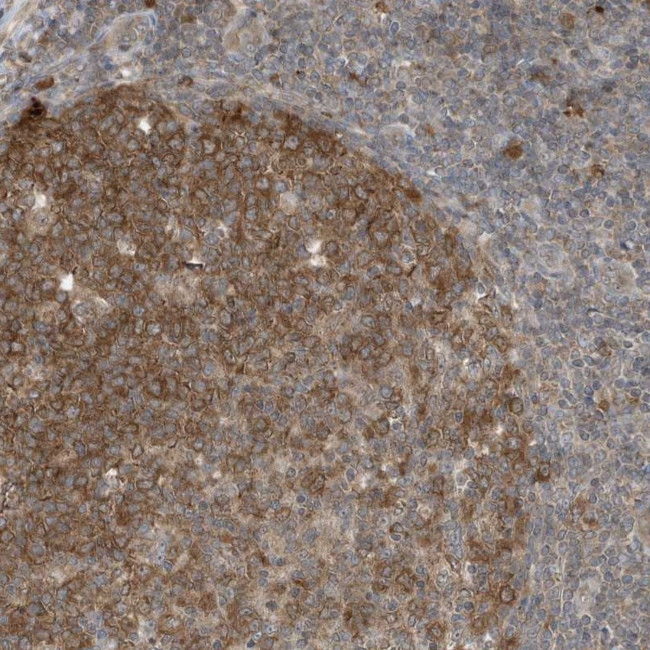 TXNDC9 Antibody in Immunohistochemistry (Paraffin) (IHC (P))