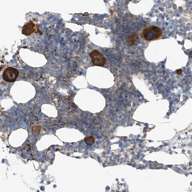 NALCN Antibody in Immunohistochemistry (Paraffin) (IHC (P))