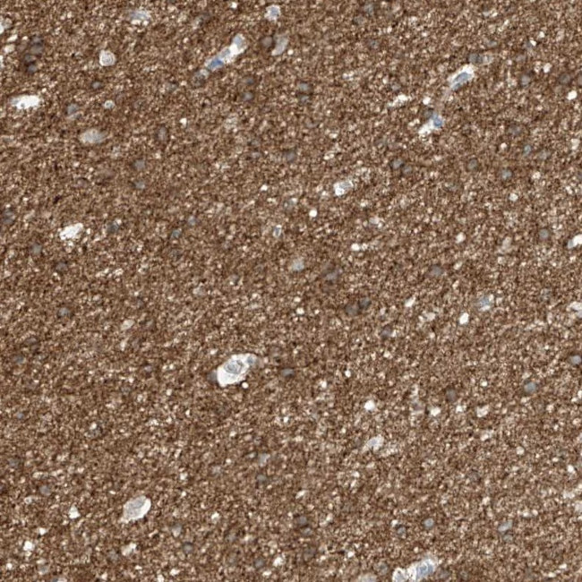 NALCN Antibody in Immunohistochemistry (Paraffin) (IHC (P))