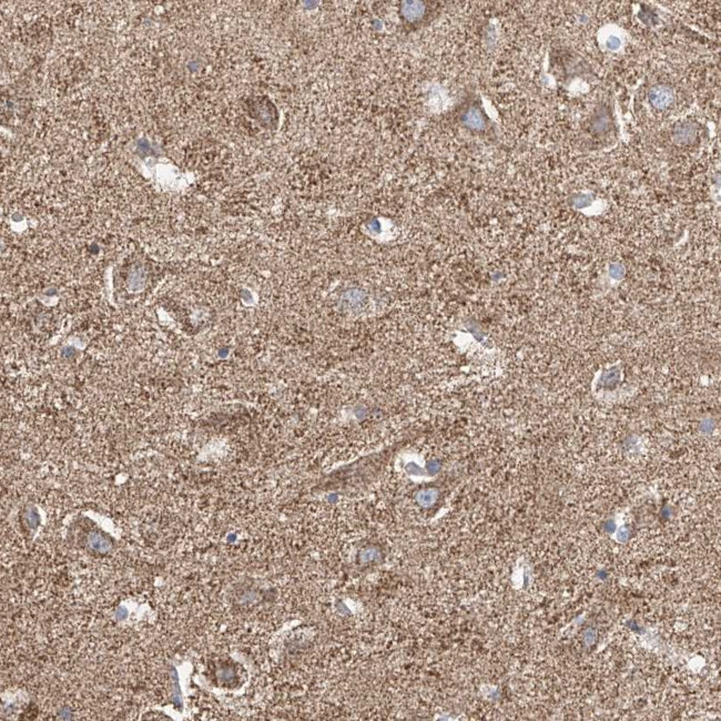 NALCN Antibody in Immunohistochemistry (Paraffin) (IHC (P))