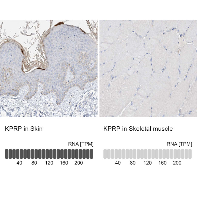 KPRP Antibody in Immunohistochemistry (IHC)