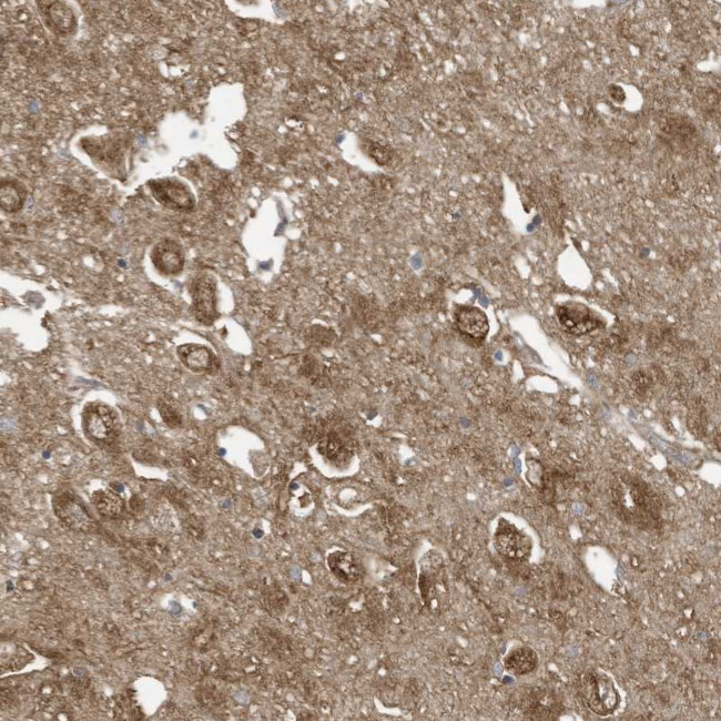 COX10 Antibody in Immunohistochemistry (Paraffin) (IHC (P))