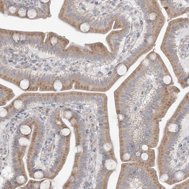 MMGT1 Antibody in Immunohistochemistry (Paraffin) (IHC (P))