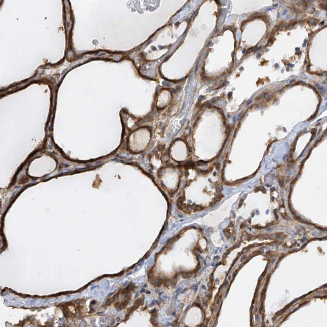 KLHDC9 Antibody in Immunohistochemistry (Paraffin) (IHC (P))