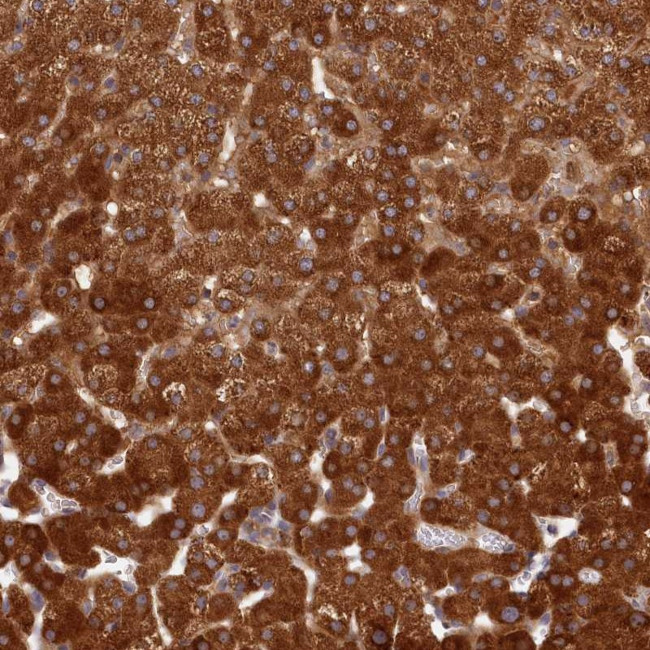 LSS Antibody in Immunohistochemistry (Paraffin) (IHC (P))