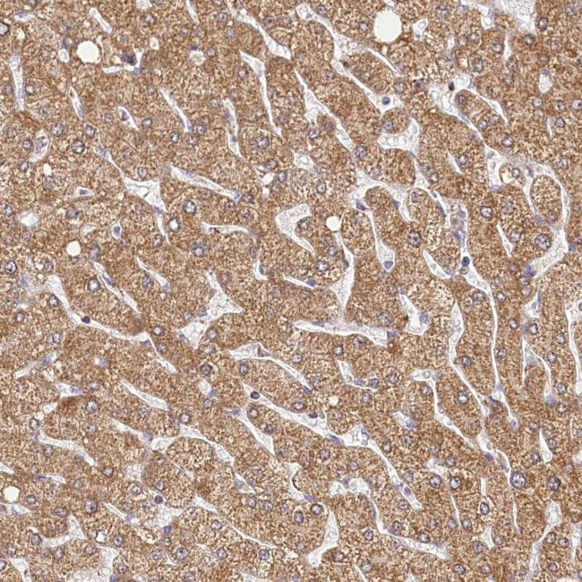 LSS Antibody in Immunohistochemistry (IHC)