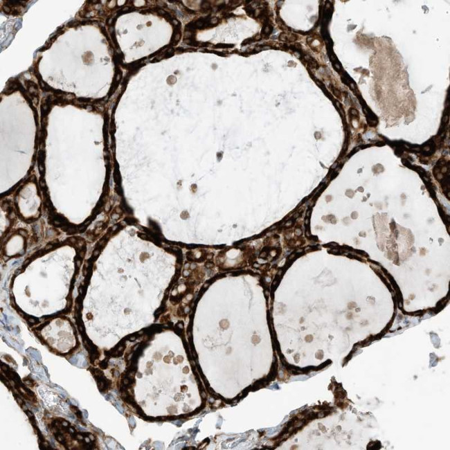 TRSPAP1 Antibody in Immunohistochemistry (Paraffin) (IHC (P))