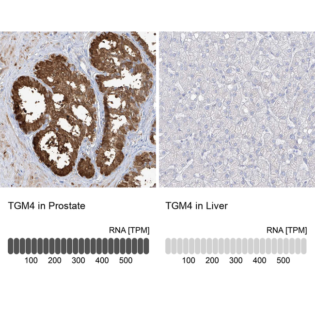 TGM4 Antibody in Immunohistochemistry (Paraffin) (IHC (P))