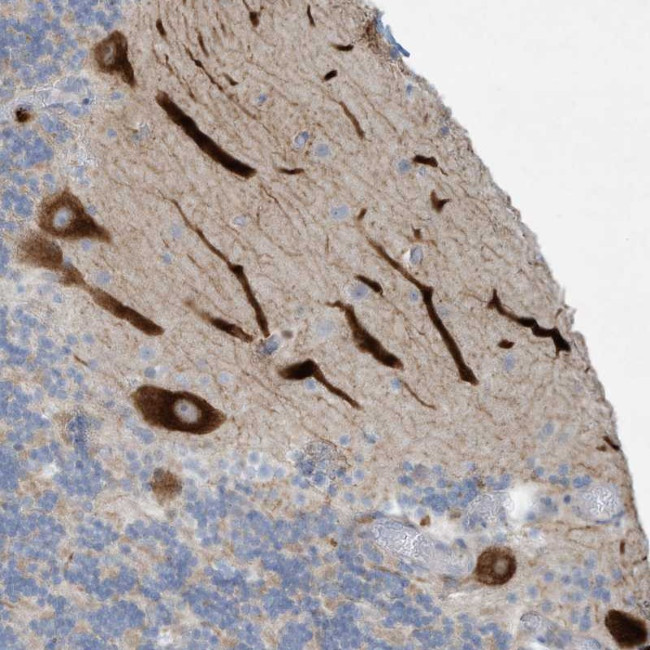 TUBE1 Antibody in Immunohistochemistry (Paraffin) (IHC (P))