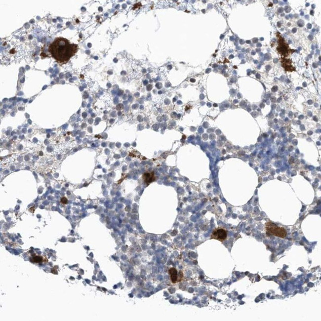 GPATCH3 Antibody in Immunohistochemistry (IHC)