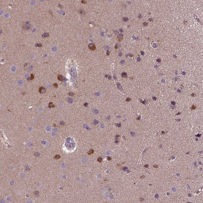 Kazrin Antibody in Immunohistochemistry (Paraffin) (IHC (P))