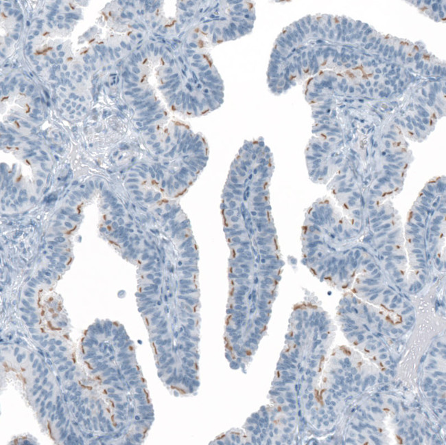 FAM161A Antibody in Immunohistochemistry (Paraffin) (IHC (P))