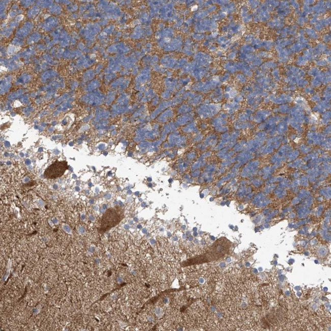 ABHD13 Antibody in Immunohistochemistry (Paraffin) (IHC (P))
